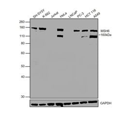 Invitrogen MSH6 Recombinant Rabbit Monoclonal Antibody (021) 100 &mu;L;