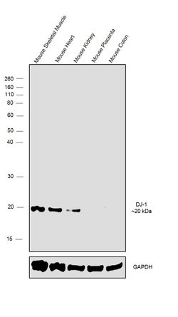 DJ-1 Recombinant Rabbit Monoclonal Antibody (007), Invitrogen 100 &mu;L;