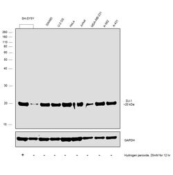 DJ-1 Recombinant Rabbit Monoclonal Antibody (007), Invitrogen 100 &mu;L;