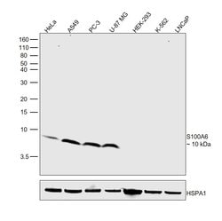Invitrogen S100A6 Monoclonal Antibody (03) 100 &mu;L | Buy Online | Invitrogen&trade; | Fisher Scientific