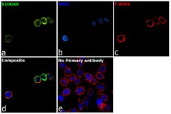 Invitrogen S100A9 Recombinant Rabbit Monoclonal Antibody (018) 100 &mu;L;