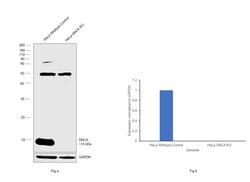 Invitrogen alpha Synuclein Recombinant Rabbit Monoclonal Antibody (017)