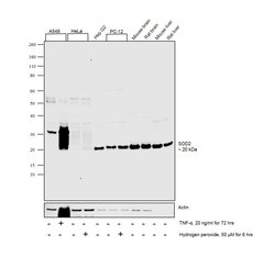 Invitrogen SOD2 Recombinant Rabbit Monoclonal Antibody (001) 100 &mu;L;