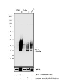 Invitrogen SOD2 Recombinant Rabbit Monoclonal Antibody (012) 100 &mu;L;