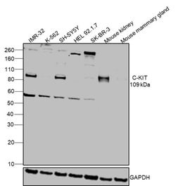 Invitrogen&trade;&nbsp;c-Kit Recombinant Rabbit Monoclonal Antibody (017)