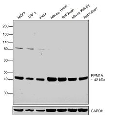 Invitrogen PPM1A Recombinant Rabbit Monoclonal Antibody (006) 100 &mu;L;