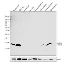 Invitrogen S100A6 Recombinant Rabbit Monoclonal Antibody (016) 100 &mu;L;