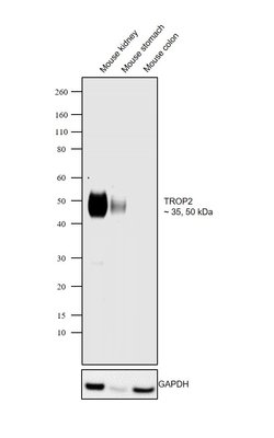 Invitrogen TROP2 Recombinant Rabbit Monoclonal Antibody (046) 100 &mu;L;