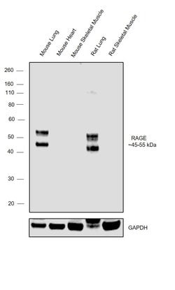 Invitrogen RAGE Recombinant Rabbit Monoclonal Antibody (005) 100 &mu;L | Buy Online | Invitrogen&trade; | Fisher Scientific
