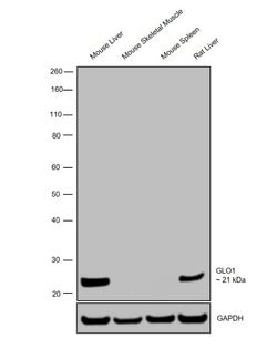 Invitrogen GLO1 Recombinant Rabbit Monoclonal Antibody (043) 100 &mu;L;