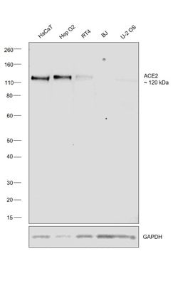 Invitrogen ACE2 Monoclonal Antibody (CL4013) 100 &mu;L; Unconjugated:Antibodies,