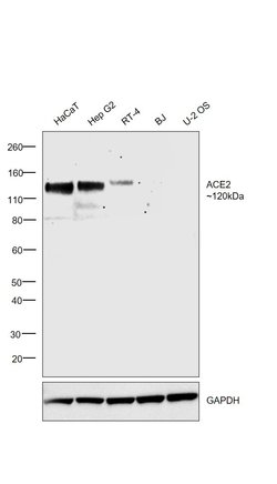 Invitrogen ACE2 Monoclonal Antibody (CL4035) 100 &mu;L; Unconjugated:Antibodies,