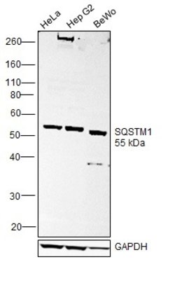 Invitrogen SQSTM1 Monoclonal Antibody (GT239) 100 &mu;L | Buy Online | Invitrogen&trade; | Fisher Scientific