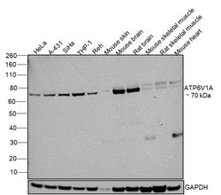 Invitrogen ATP6V1A Monoclonal Antibody (GT1561) 100 &mu;L; Unconjugated:Antibodies,
