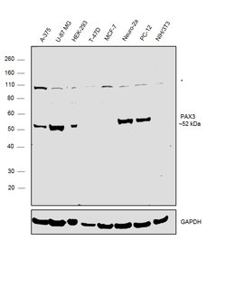 Invitrogen PAX3 Monoclonal Antibody (GT2411) 100 &mu;L; Unconjugated:Antibodies,