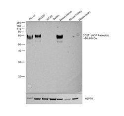 Invitrogen CD271 (NGF Receptor) Recombinant Rabbit Monoclonal Antibody (SA39-02) 100 &mu;L | Buy Online | Invitrogen&trade; | Fisher Scientific