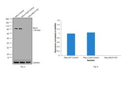 MLH1 Recombinant Rabbit Monoclonal Antibody (SP08-04):Antibodies, Recombinant