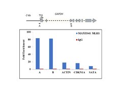 MLH1 Recombinant Rabbit Monoclonal Antibody (SP08-04):Antibodies, Recombinant