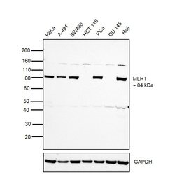 MLH1 Recombinant Rabbit Monoclonal Antibody (SP08-04):Antibodies, Recombinant