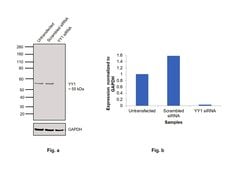 Invitrogen YY1 Recombinant Rabbit Monoclonal Antibody (SY29-01) 100 &mu;L;