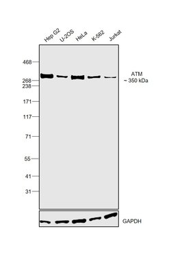 Invitrogen ATM Recombinant Rabbit Monoclonal Antibody (SI70-01) 100 &mu;L | Buy Online | Invitrogen&trade; | Fisher Scientific