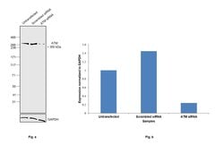Invitrogen ATM Recombinant Rabbit Monoclonal Antibody (SI70-01) 100 &mu;L | Buy Online | Invitrogen&trade; | Fisher Scientific