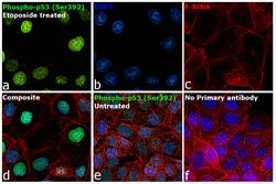 Invitrogen Phospho-p53 (Ser392) Recombinant Rabbit Monoclonal Antibody