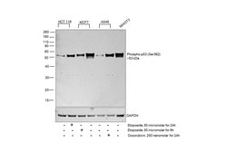 Invitrogen Phospho-p53 (Ser392) Recombinant Rabbit Monoclonal Antibody