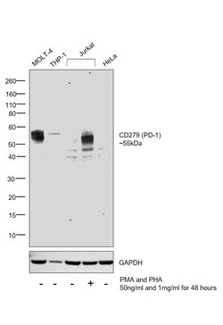 Invitrogen CD279 (PD-1) Recombinant Rabbit Monoclonal Antibody (SJ01-91)