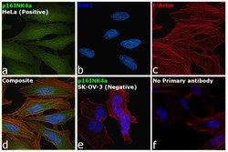 Invitrogen p16INK4a Recombinant Rabbit Monoclonal Antibody (SU0702) 100