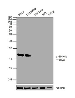 Invitrogen p16INK4a Recombinant Rabbit Monoclonal Antibody (SU0702) 100