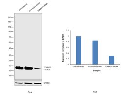 Invitrogen TOMM20 Recombinant Rabbit Monoclonal Antibody (ST04-72) 100