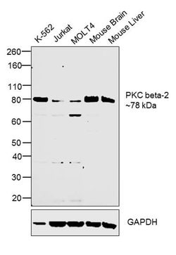 Invitrogen PKC beta-2 Recombinant Rabbit Monoclonal Antibody (ST48-06)