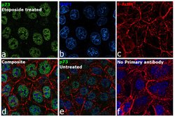 Invitrogen p73 Recombinant Rabbit Monoclonal Antibody (ST05-76) 100 &mu;L;