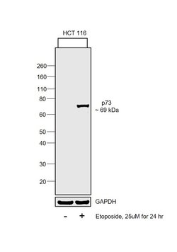 Invitrogen p73 Recombinant Rabbit Monoclonal Antibody (ST05-76) 100 &mu;L;