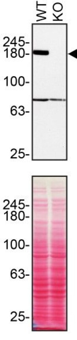 Invitrogen TSC2 Recombinant Rabbit Monoclonal Antibody (SC05-59) 100 &mu;L;