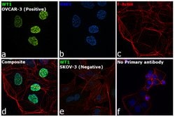 Invitrogen WT1 Recombinant Rabbit Monoclonal Antibody (SC06-41) 100 &mu;L;