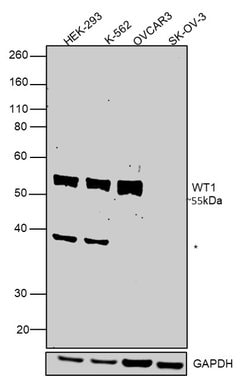 Invitrogen WT1 Recombinant Rabbit Monoclonal Antibody (SC06-41) 100 &mu;L;