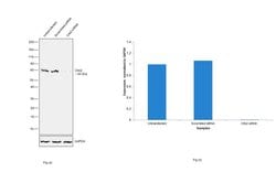 Invitrogen CHK2 Recombinant Rabbit Monoclonal Antibody (SC604) 100 &mu;L;