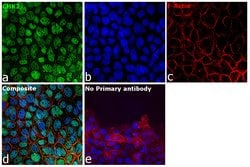Invitrogen CHK2 Recombinant Rabbit Monoclonal Antibody (SC604) 100 &mu;L;