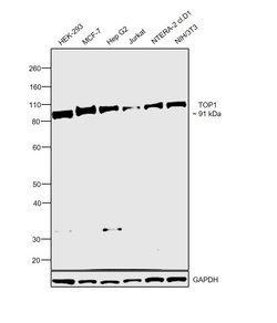 Invitrogen TOP1 Recombinant Rabbit Monoclonal Antibody (SC69-03) 100 &mu;L;