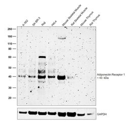 Invitrogen Adiponectin Receptor 1 Recombinant Rabbit Monoclonal Antibody