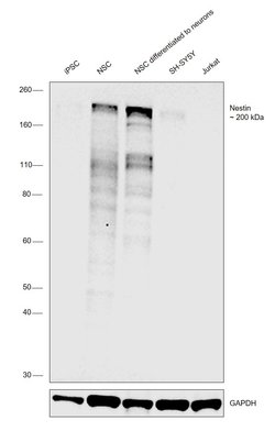Invitrogen Nestin Recombinant Rabbit Monoclonal Antibody (SN06-27) 100