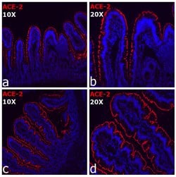 Invitrogen ACE2 Recombinant Rabbit Monoclonal Antibody (SN0754) 100 &mu;L | Buy Online | Invitrogen&trade; | Fisher Scientific