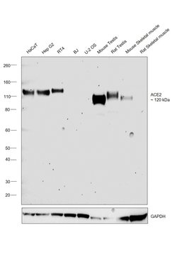 Invitrogen ACE2 Recombinant Rabbit Monoclonal Antibody (SN0754) 100 &mu;L | Buy Online | Invitrogen&trade; | Fisher Scientific