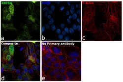 Invitrogen Cytokeratin 6 Recombinant Rabbit Monoclonal Antibody (SN71-07)