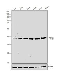 Invitrogen Bcl-10 Recombinant Rabbit Monoclonal Antibody (SN74-04) 100 &mu;L | Buy Online | Invitrogen&trade; | Fisher Scientific