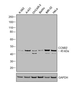 Invitrogen Cyclin B2 Recombinant Rabbit Monoclonal Antibody (SD2045) 100 &mu;L | Buy Online | Invitrogen&trade; | Fisher Scientific