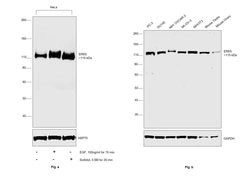 Invitrogen ERK5 Recombinant Rabbit Monoclonal Antibody (SD2084) 100 &mu;L;