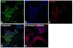 Invitrogen CDK9 Recombinant Rabbit Monoclonal Antibody (SD204-07) 100 &mu;L;